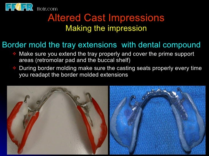 altered cast technique