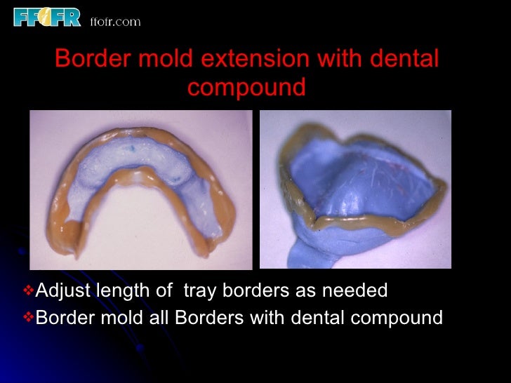 Impressions and physiologic adjustment