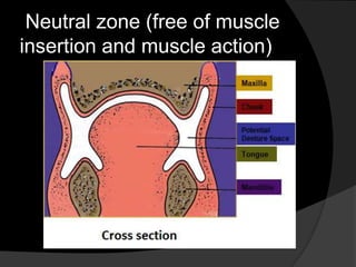 Neutral zone (free of muscle 
insertion and muscle action) 
 