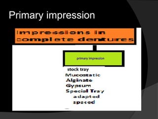 Primary impression 
 