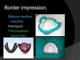 Border impression. 
Silicone medium 
viscosity 
Impregum 
Thermoplastic 
green Kerr 
 