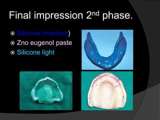 Final impression 2nd phase. 
 Silicone (medium) 
 Zno eugenol paste 
 Silicone light 
 