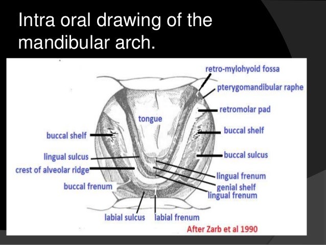 maxillary alginate impression ratio maxillary alginate impression ratio