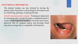 Comprehensive Impression Techniques for Complete Denture Fabrication | PPTX