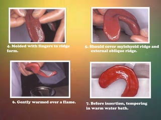 Impressions in complete dentures | PPTX