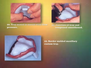 5. Pencil mark 
transferred to fitting 
surface. 
7. Anterior border of the tray 
adjusted. 
6. Tray border should be 
res...