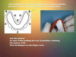 Apply compound to area “C”. 
Temper, insert and gently 
massage the lower lip. Simulate 
muscular activity by 
slightly li...