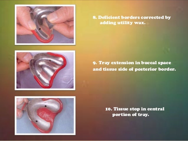 impressions in complete dentures primary impression