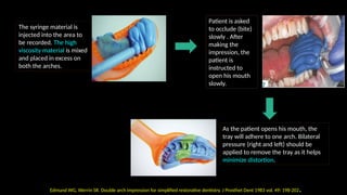 Fixed Impression Impressions In Fixed Dental Prosthesis (JC3).pptx