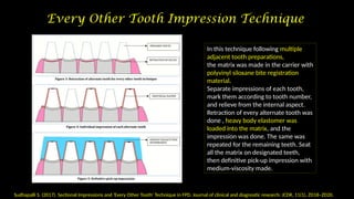 Impressions In Fixed Dental Prosthesis (JC3).pptx