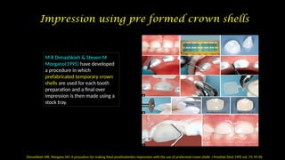 Fixed Impression Impressions In Fixed Dental Prosthesis (JC3).pptx