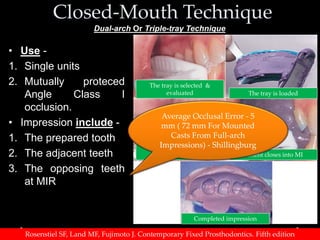Fixed Impression Impressions in fixed partial denture | PPTX