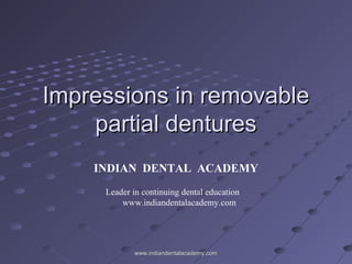 Impressions in removableImpressions in removable
partial denturespartial dentures
INDIAN DENTAL ACADEMY
Leader in continuing dental education
www.indiandentalacademy.com
www.indiandentalacademy.comwww.indiandentalacademy.com
 