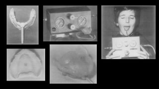 impression technique in complete denture seminar ppt.pptx