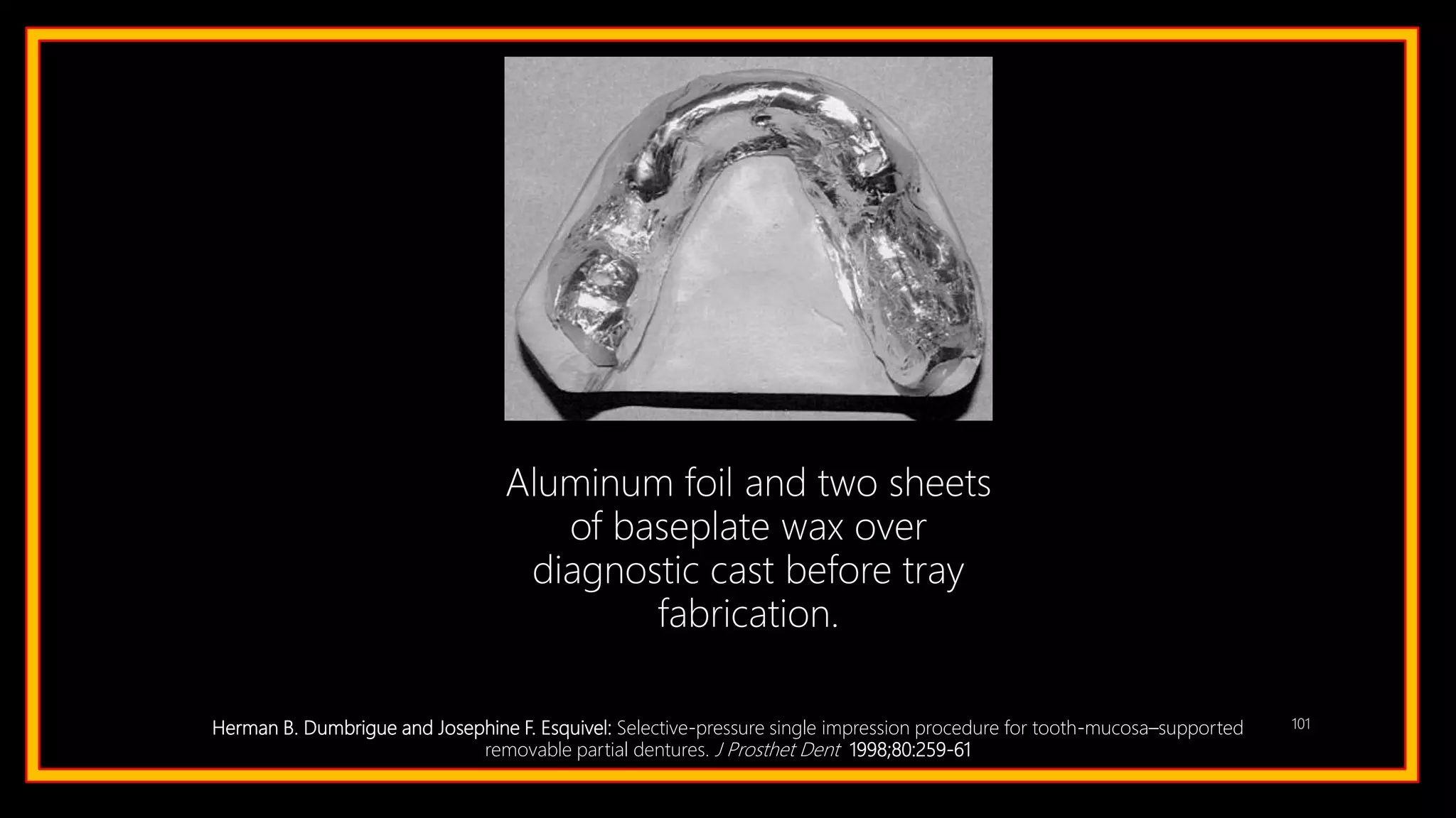 101Herman B. Dumbrigue and Josephine F. Esquivel: Selective-pressure single impression procedure for tooth-mucosa–supported
removable partial dentures. J Prosthet Dent 1998;80:259-61
Aluminum foil and two sheets
of baseplate wax over
diagnostic cast before tray
fabrication.
 