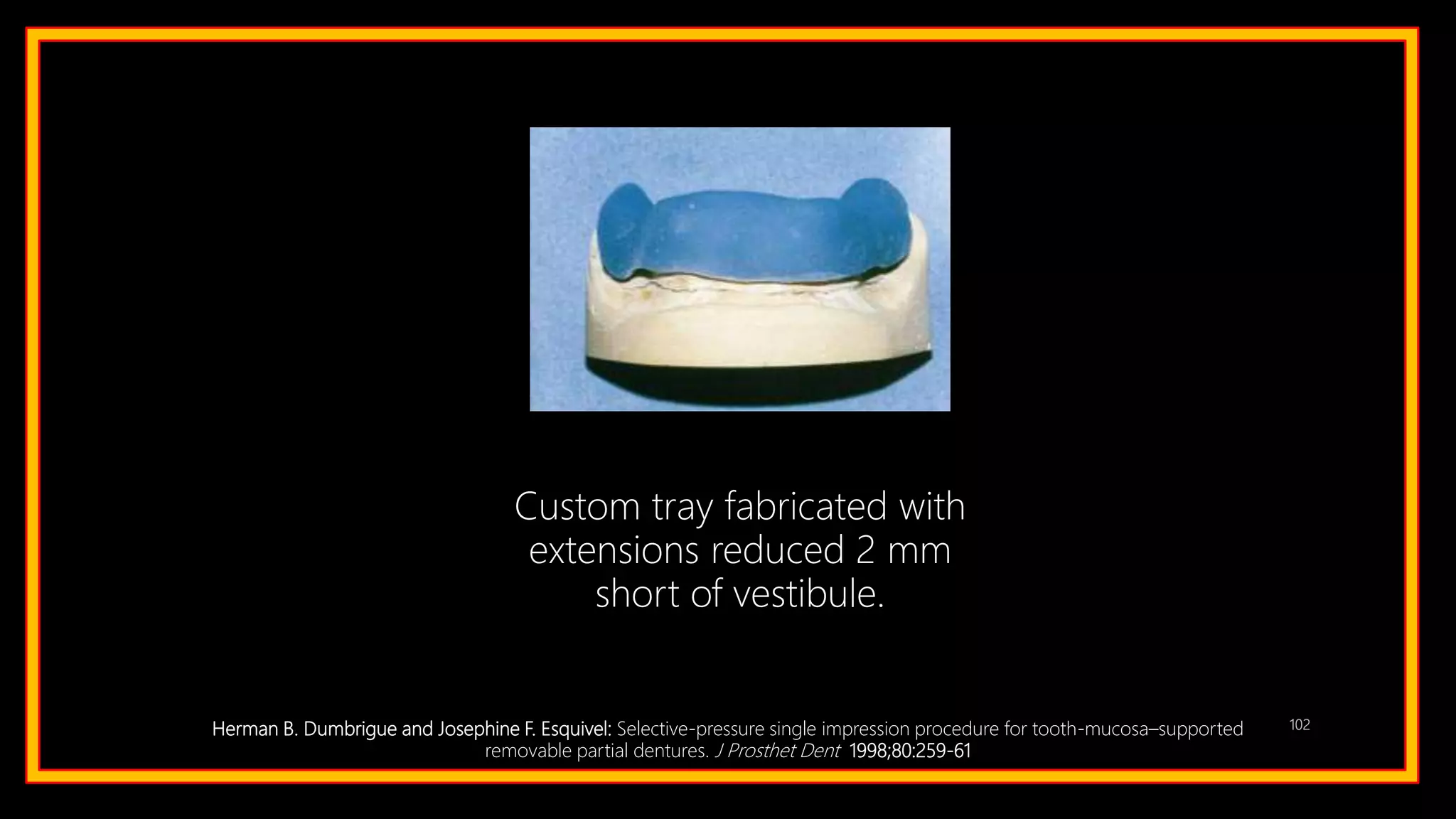 102Herman B. Dumbrigue and Josephine F. Esquivel: Selective-pressure single impression procedure for tooth-mucosa–supported
removable partial dentures. J Prosthet Dent 1998;80:259-61
Custom tray fabricated with
extensions reduced 2 mm
short of vestibule.
 