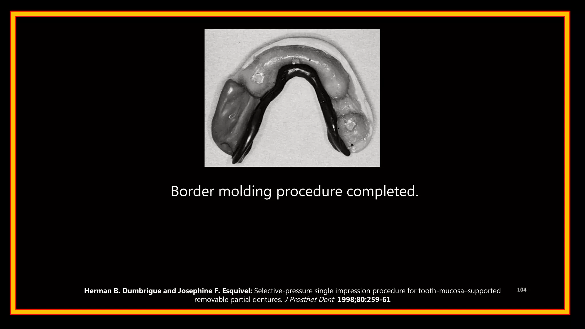 104Herman B. Dumbrigue and Josephine F. Esquivel: Selective-pressure single impression procedure for tooth-mucosa–supported
removable partial dentures. J Prosthet Dent 1998;80:259-61
Border molding procedure completed.
 