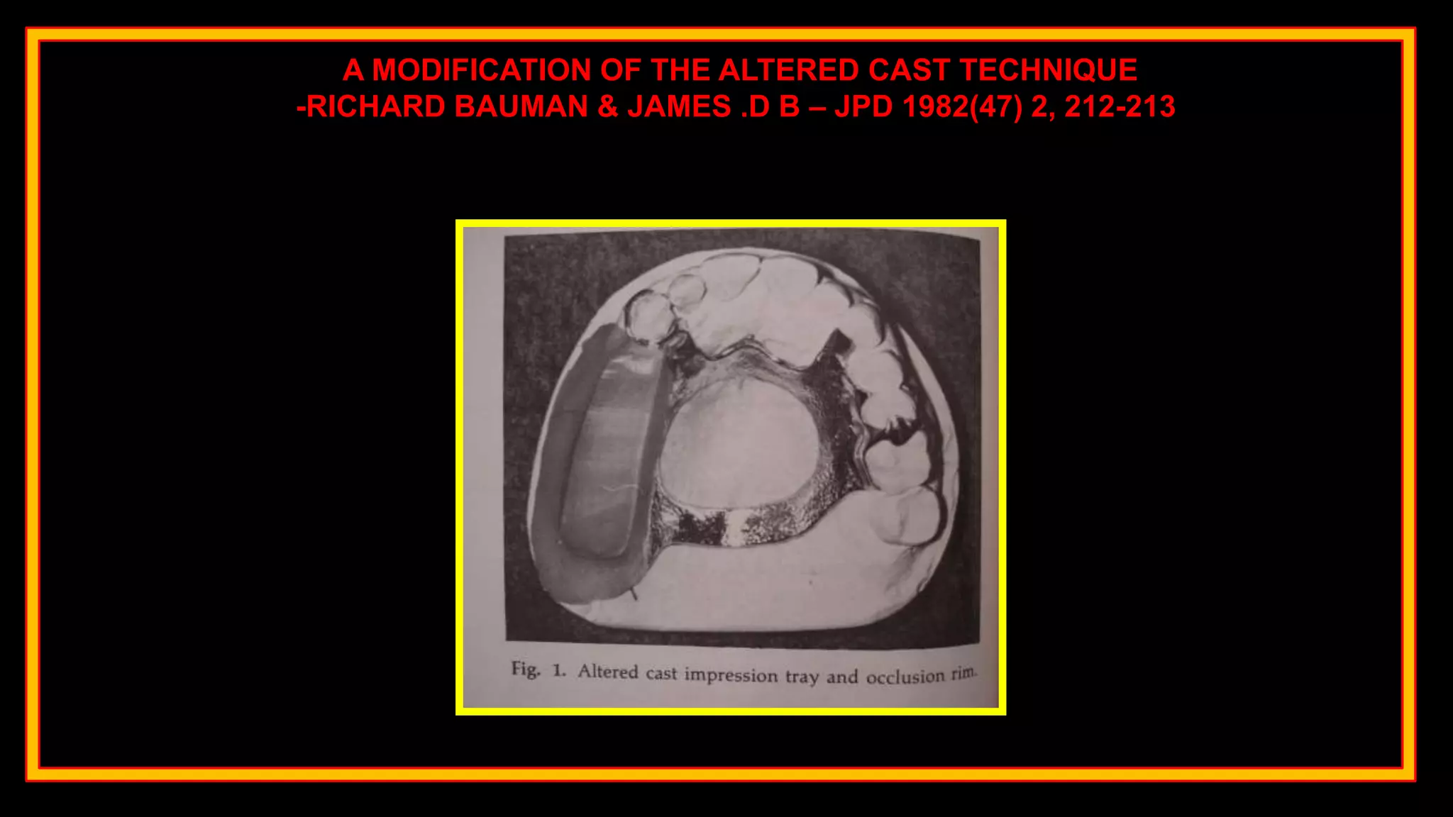 A MODIFICATION OF THE ALTERED CAST TECHNIQUE
-RICHARD BAUMAN & JAMES .D B – JPD 1982(47) 2, 212-213
 