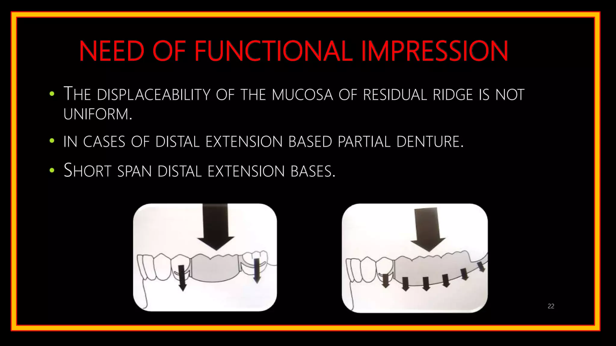NEED OF FUNCTIONAL IMPRESSION
• THE DISPLACEABILITY OF THE MUCOSA OF RESIDUAL RIDGE IS NOT
UNIFORM.
• IN CASES OF DISTAL EXTENSION BASED PARTIAL DENTURE.
• SHORT SPAN DISTAL EXTENSION BASES.
22
 