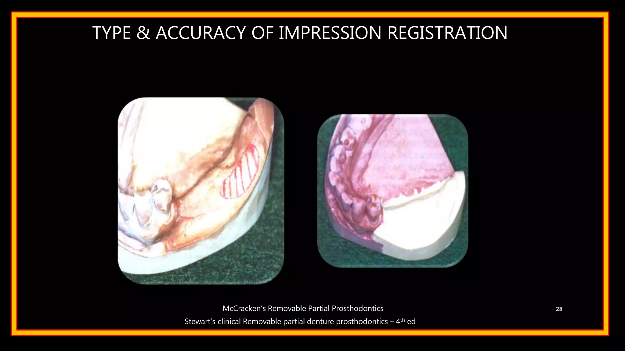 TYPE & ACCURACY OF IMPRESSION REGISTRATION
28
Stewart’s clinical Removable partial denture prosthodontics – 4th ed
McCracken’s Removable Partial Prosthodontics
 