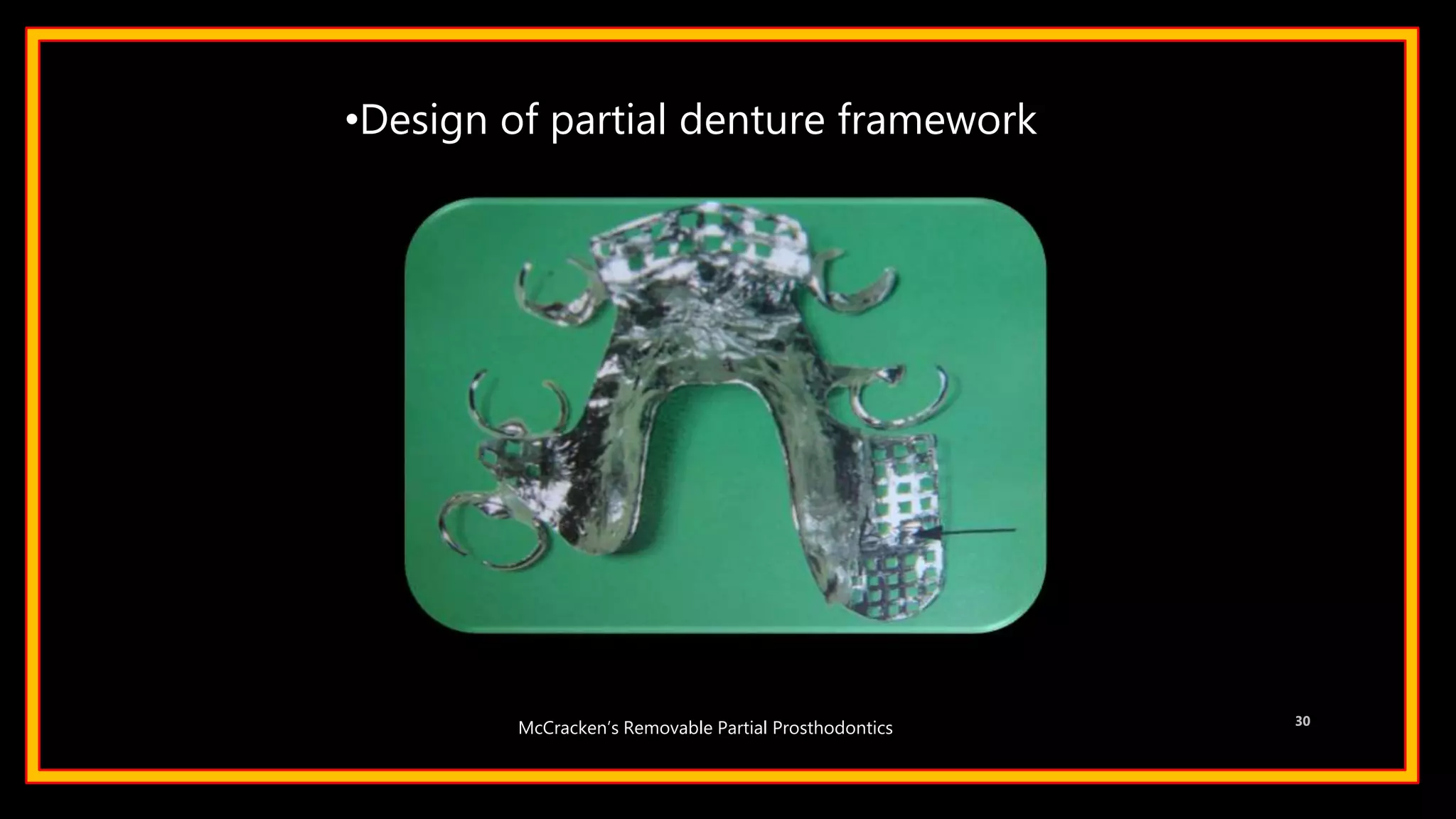 •Design of partial denture framework
30
McCracken’s Removable Partial Prosthodontics
 