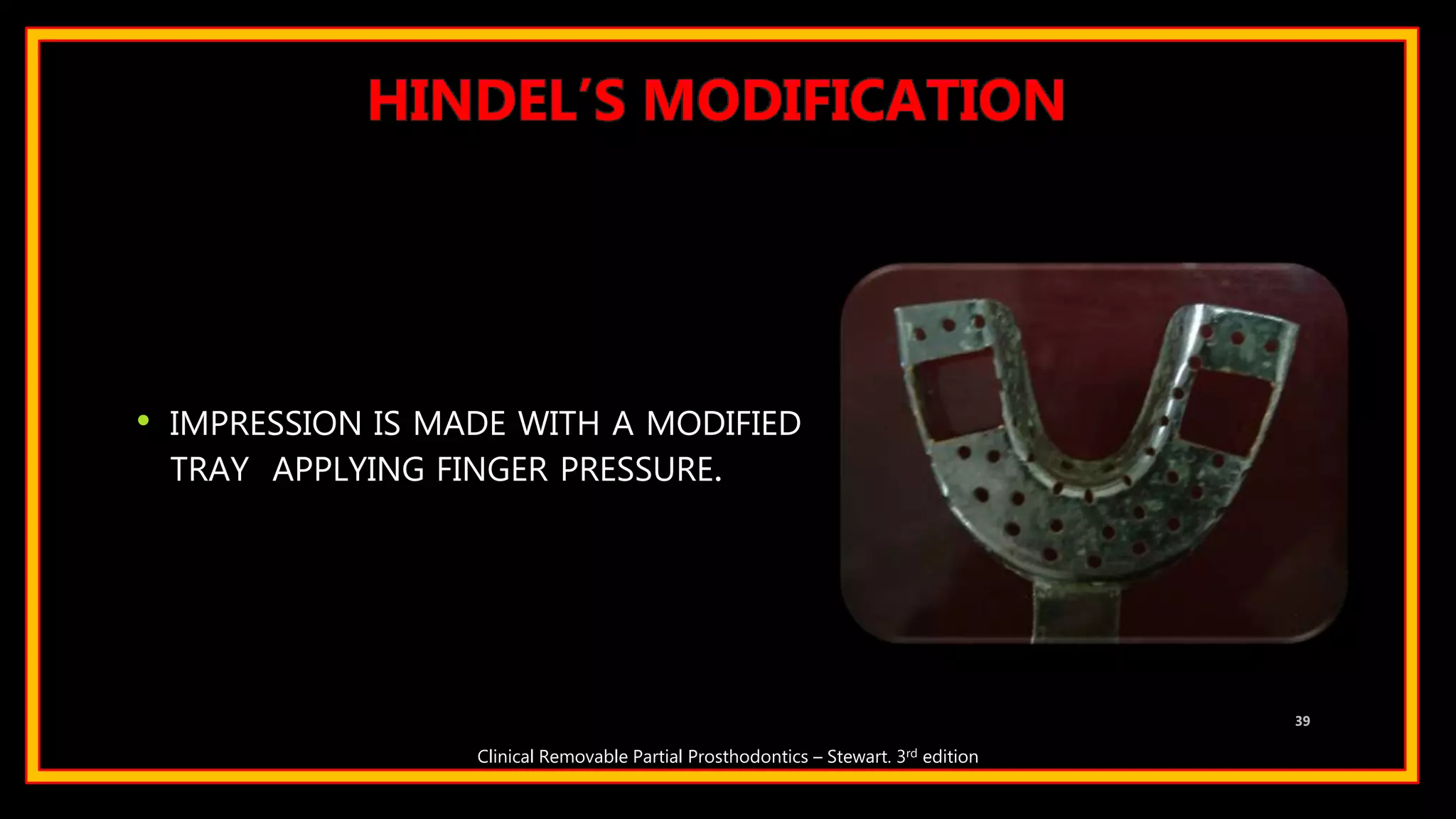 • IMPRESSION IS MADE WITH A MODIFIED
TRAY APPLYING FINGER PRESSURE.
39
Clinical Removable Partial Prosthodontics – Stewart. 3rd edition
HINDEL’S MODIFICATION
 