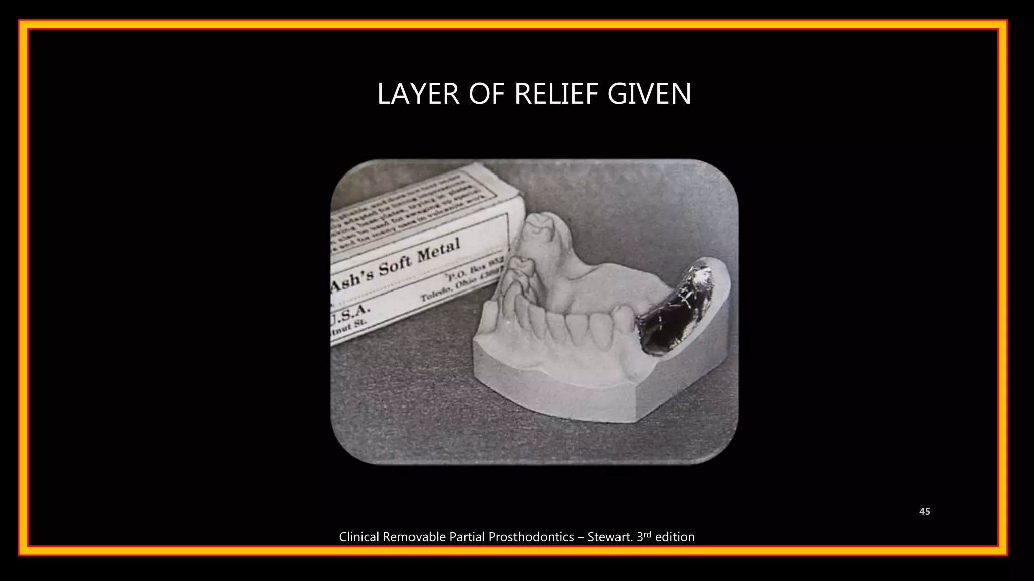 LAYER OF RELIEF GIVEN
45
Clinical Removable Partial Prosthodontics – Stewart. 3rd edition
 