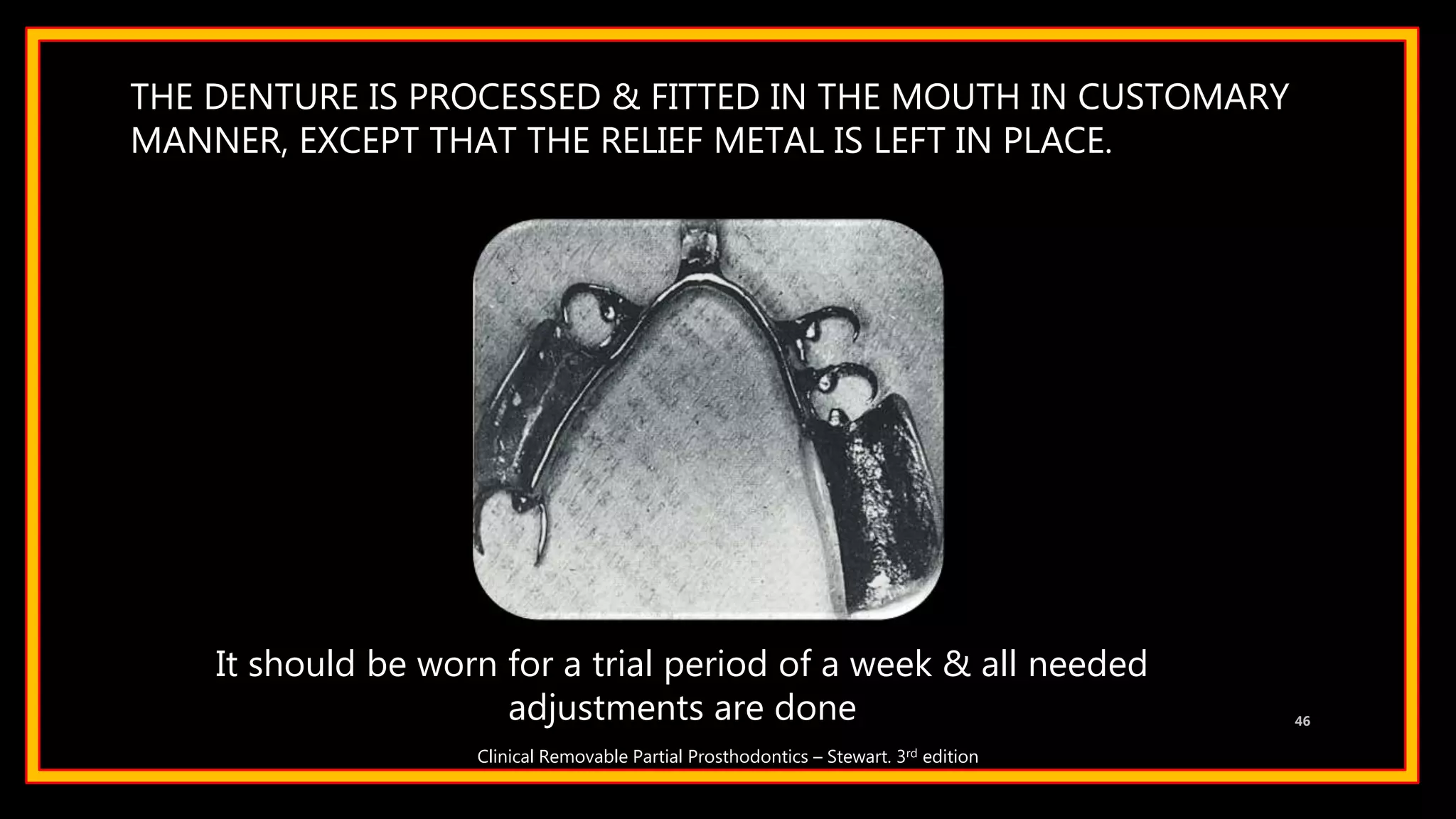 THE DENTURE IS PROCESSED & FITTED IN THE MOUTH IN CUSTOMARY
MANNER, EXCEPT THAT THE RELIEF METAL IS LEFT IN PLACE.
46
It should be worn for a trial period of a week & all needed
adjustments are done
Clinical Removable Partial Prosthodontics – Stewart. 3rd edition
 
