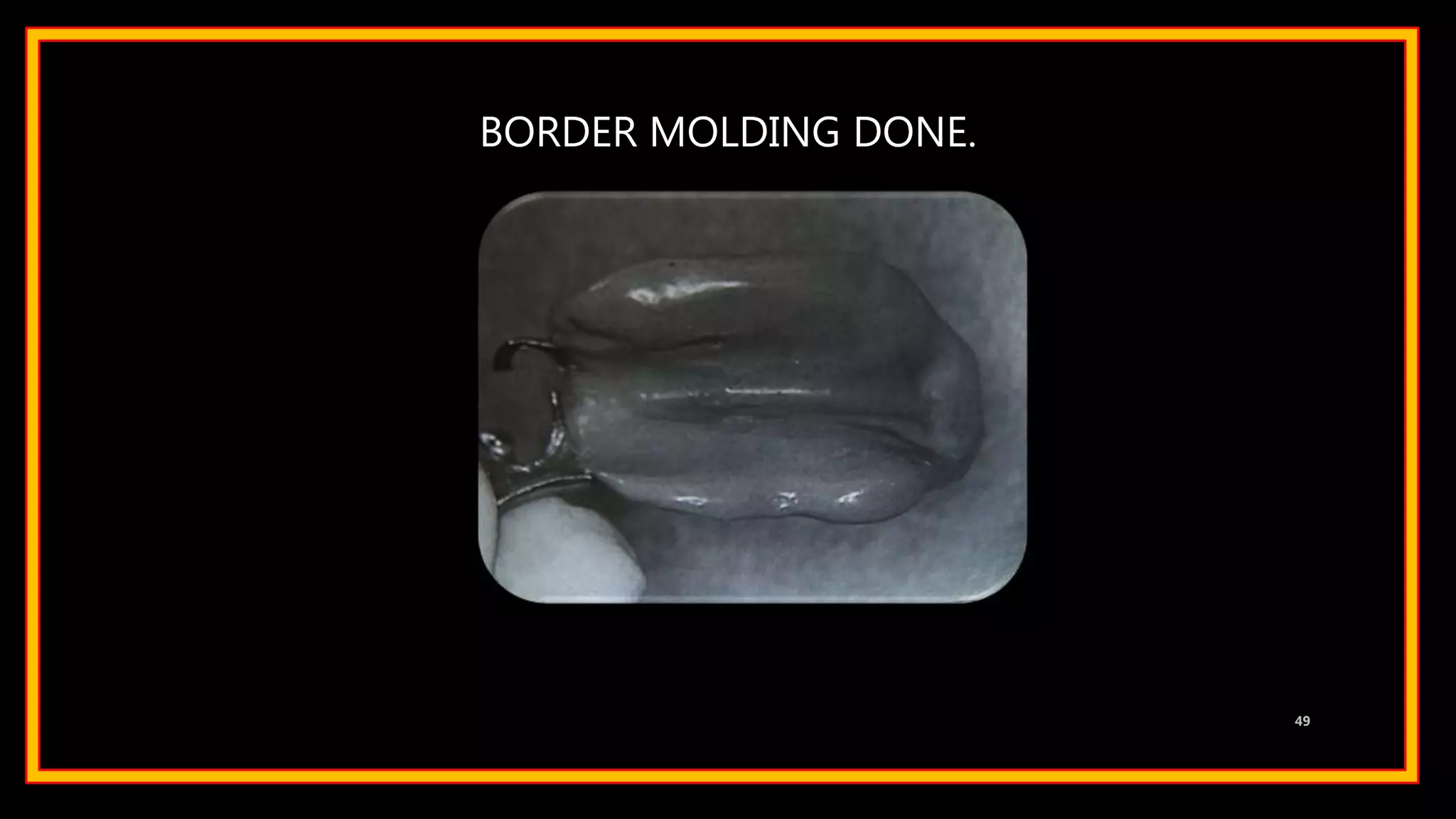 BORDER MOLDING DONE.
49
 