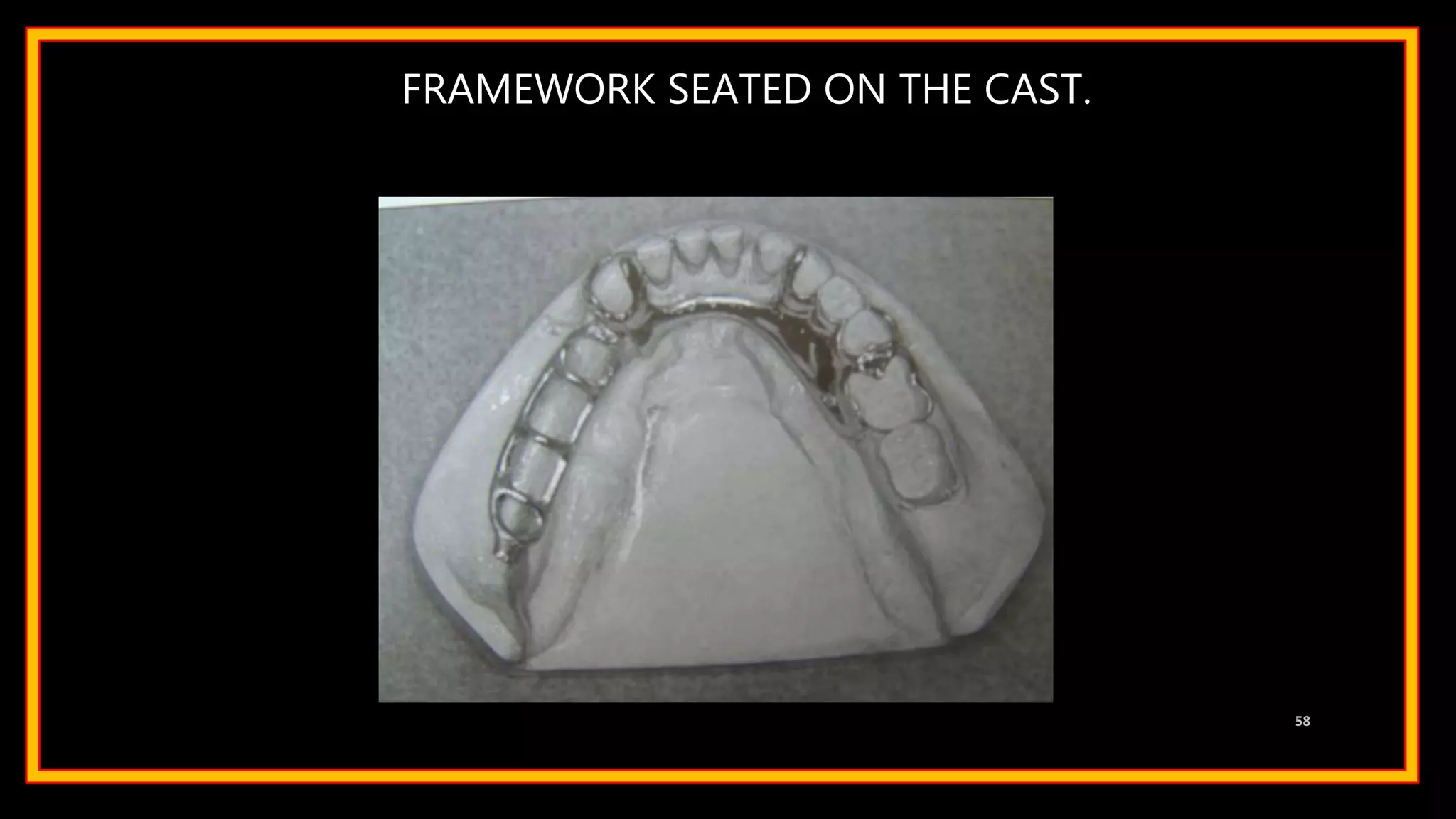 FRAMEWORK SEATED ON THE CAST.
58
 