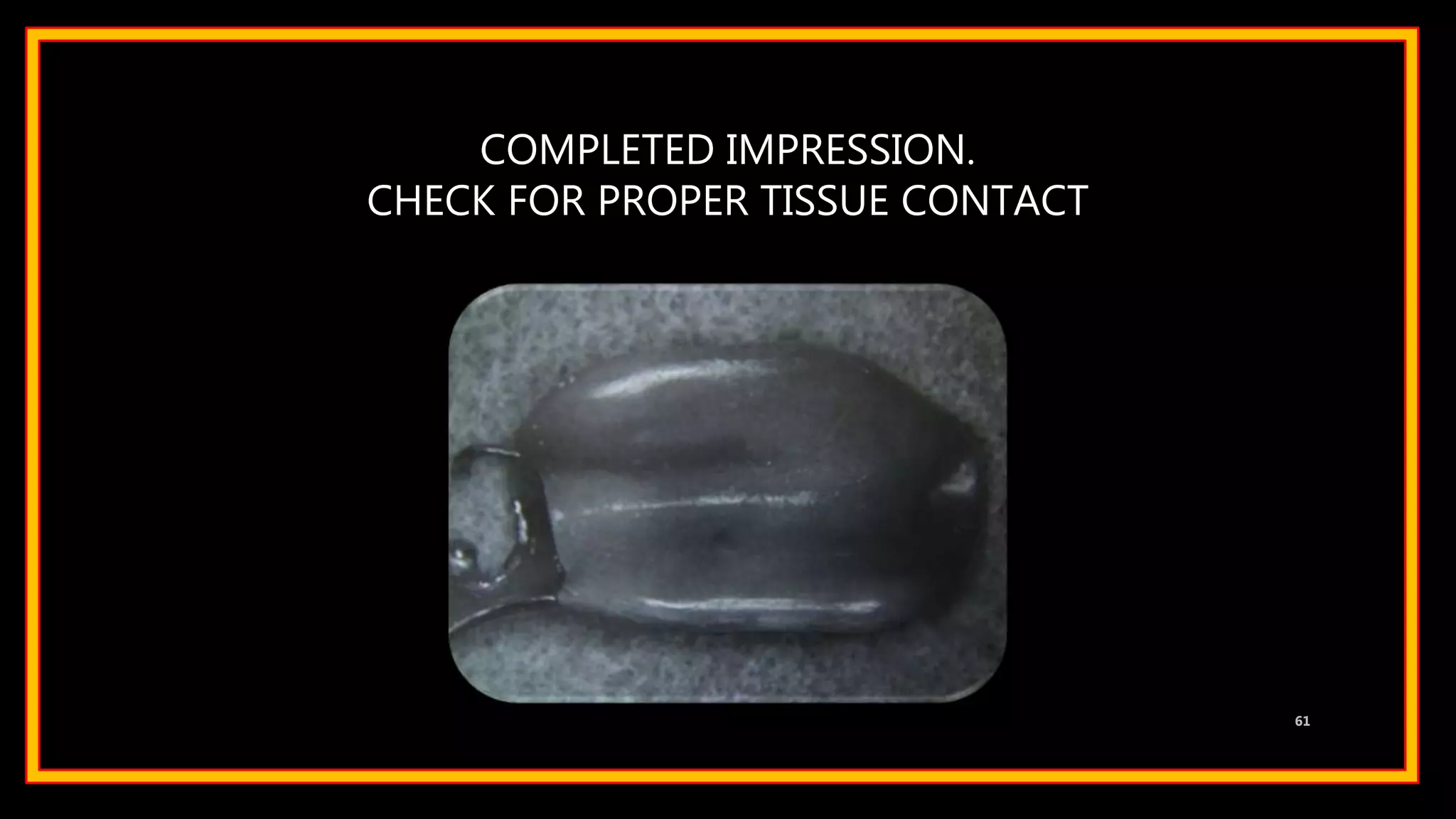 COMPLETED IMPRESSION.
CHECK FOR PROPER TISSUE CONTACT
61
 