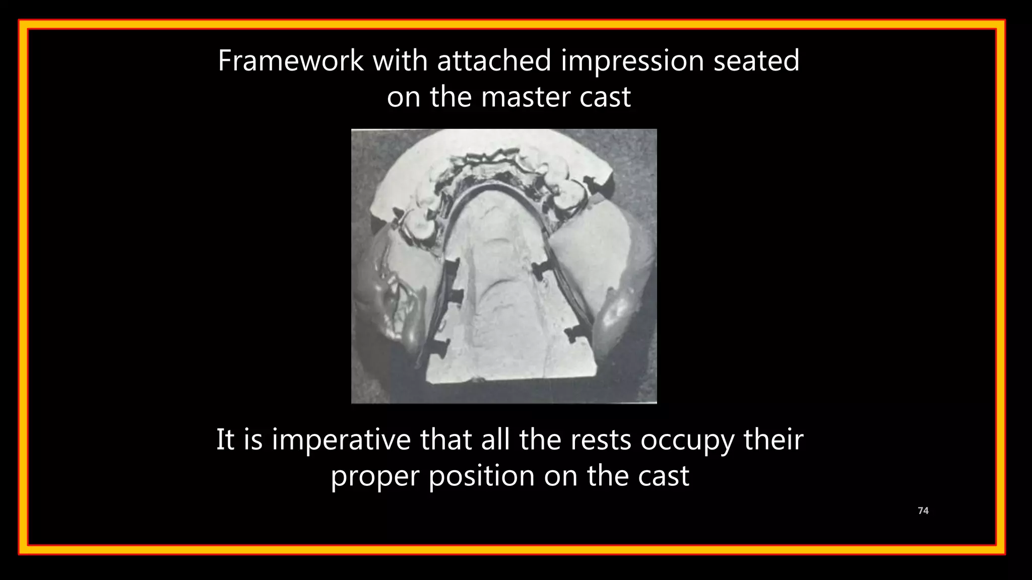Framework with attached impression seated
on the master cast
It is imperative that all the rests occupy their
proper position on the cast
74
 