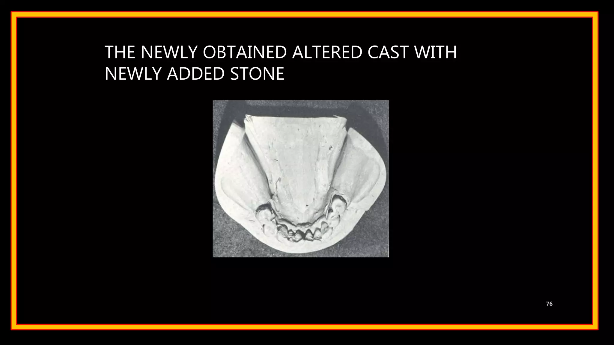 THE NEWLY OBTAINED ALTERED CAST WITH
NEWLY ADDED STONE
76
 
