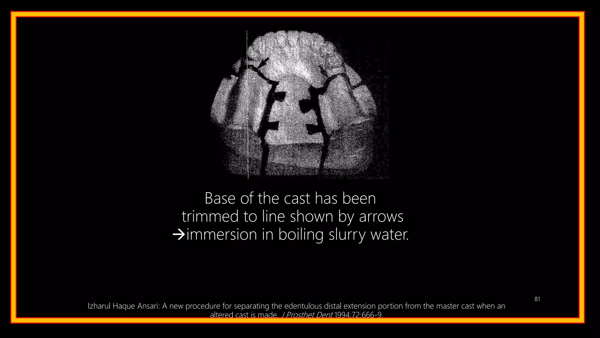 81
Base of the cast has been
trimmed to line shown by arrows
immersion in boiling slurry water.
Izharul Haque Ansari: A new procedure for separating the edentulous distal extension portion from the master cast when an
altered cast is made. J Prosthet Dent 1994;72:666-9.
 