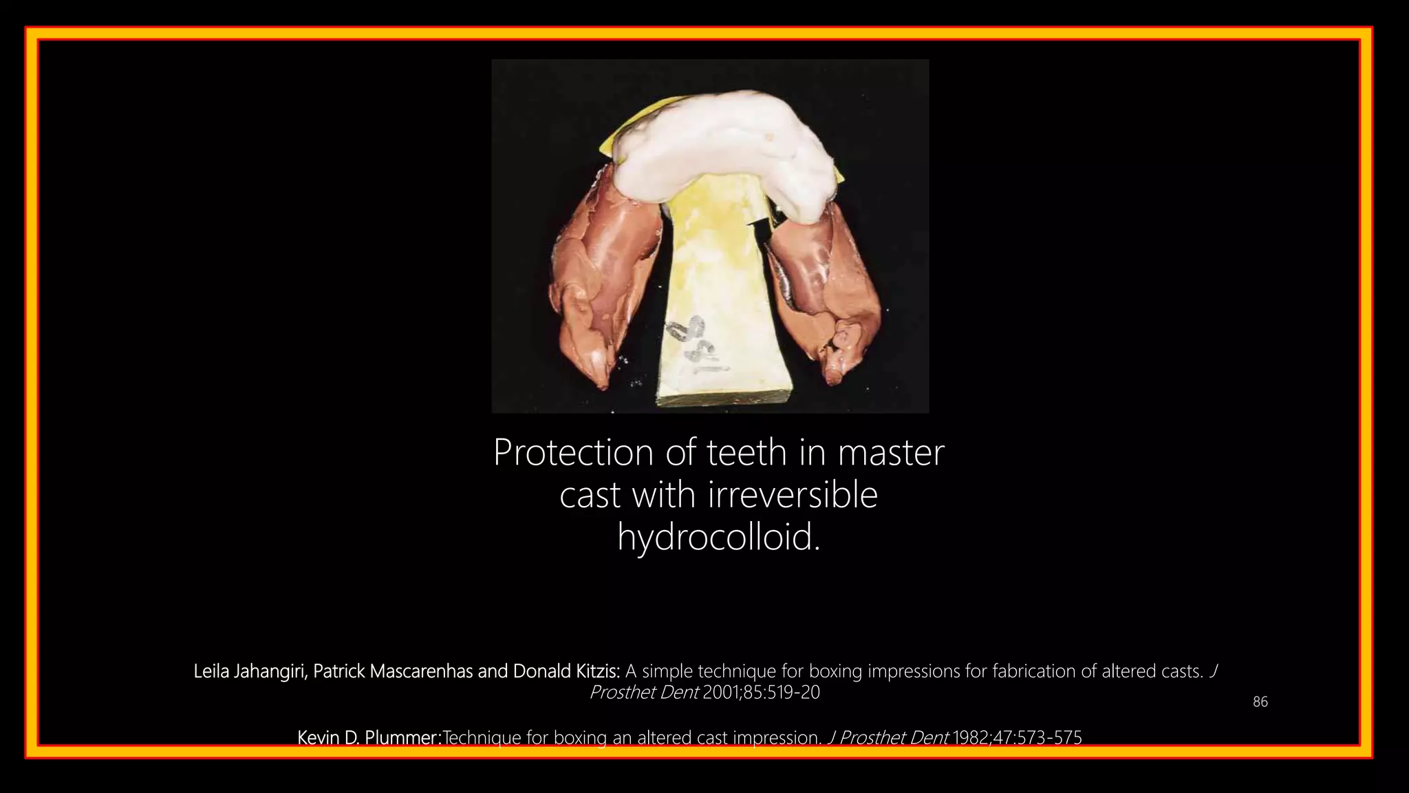 86
Protection of teeth in master
cast with irreversible
hydrocolloid.
Leila Jahangiri, Patrick Mascarenhas and Donald Kitzis: A simple technique for boxing impressions for fabrication of altered casts. J
Prosthet Dent 2001;85:519-20
Kevin D. Plummer:Technique for boxing an altered cast impression. J Prosthet Dent 1982;47:573-575
 