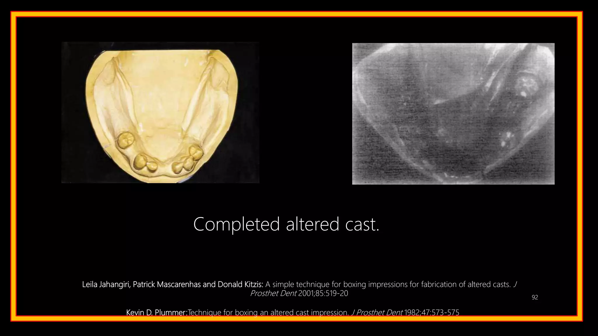 92
Completed altered cast.
Leila Jahangiri, Patrick Mascarenhas and Donald Kitzis: A simple technique for boxing impressions for fabrication of altered casts. J
Prosthet Dent 2001;85:519-20
Kevin D. Plummer:Technique for boxing an altered cast impression. J Prosthet Dent 1982;47:573-575
 