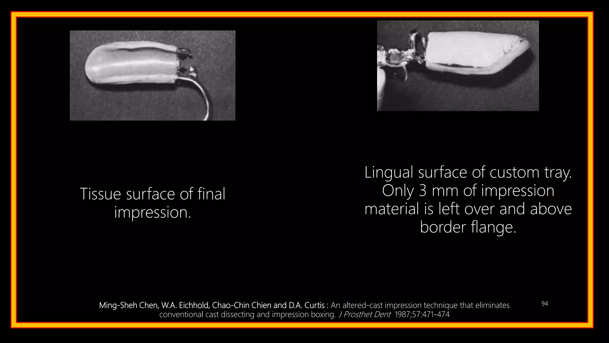 94Ming-Sheh Chen, W.A. Eichhold, Chao-Chin Chien and D.A. Curtis : An altered-cast impression technique that eliminates
conventional cast dissecting and impression boxing. J Prosthet Dent 1987;57:471-474
Tissue surface of final
impression.
Lingual surface of custom tray.
Only 3 mm of impression
material is left over and above
border flange.
 