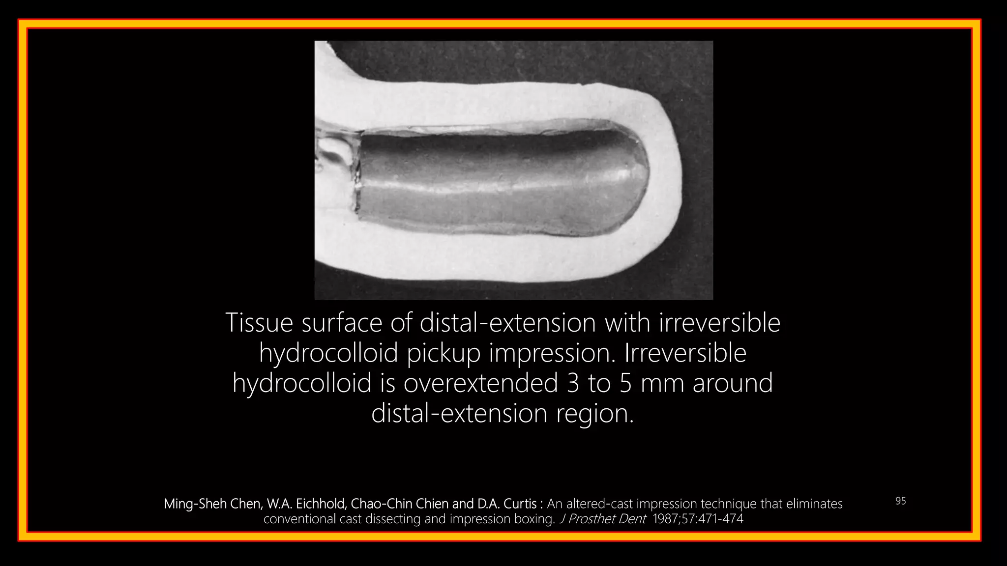 95
Tissue surface of distal-extension with irreversible
hydrocolloid pickup impression. Irreversible
hydrocolloid is overextended 3 to 5 mm around
distal-extension region.
Ming-Sheh Chen, W.A. Eichhold, Chao-Chin Chien and D.A. Curtis : An altered-cast impression technique that eliminates
conventional cast dissecting and impression boxing. J Prosthet Dent 1987;57:471-474
 