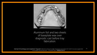 101Herman B. Dumbrigue and Josephine F. Esquivel: Selective-pressure single impression procedure for tooth-mucosa–supported
removable partial dentures. J Prosthet Dent 1998;80:259-61
Aluminum foil and two sheets
of baseplate wax over
diagnostic cast before tray
fabrication.
 