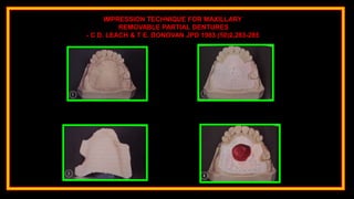 IMPRESSION TECHNIQUE FOR MAXILLARY
REMOVABLE PARTIAL DENTURES
- C D. LEACH & T E. DONOVAN JPD 1983 (50)2,283-285
 
