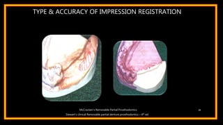 TYPE & ACCURACY OF IMPRESSION REGISTRATION
28
Stewart’s clinical Removable partial denture prosthodontics – 4th ed
McCracken’s Removable Partial Prosthodontics
 