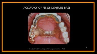 ACCURACY OF FIT OF DENTURE BASE
29
Stewart’s clinical Removable partial denture prosthodontics – 4th ed
 
