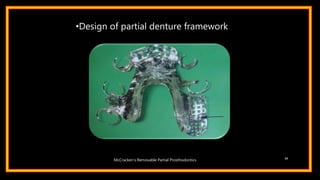 •Design of partial denture framework
30
McCracken’s Removable Partial Prosthodontics
 