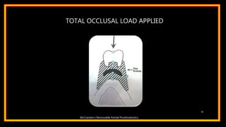TOTAL OCCLUSAL LOAD APPLIED
31
McCracken’s Removable Partial Prosthodontics
 