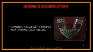 • IMPRESSION IS MADE WITH A MODIFIED
TRAY APPLYING FINGER PRESSURE.
39
Clinical Removable Partial Prosthodontics – Stewart. 3rd edition
HINDEL’S MODIFICATION
 
