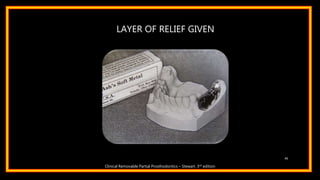 LAYER OF RELIEF GIVEN
45
Clinical Removable Partial Prosthodontics – Stewart. 3rd edition
 