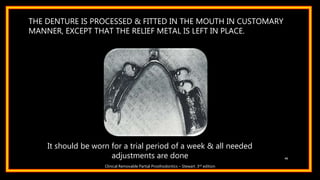THE DENTURE IS PROCESSED & FITTED IN THE MOUTH IN CUSTOMARY
MANNER, EXCEPT THAT THE RELIEF METAL IS LEFT IN PLACE.
46
It should be worn for a trial period of a week & all needed
adjustments are done
Clinical Removable Partial Prosthodontics – Stewart. 3rd edition
 