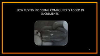 LOW FUSING MODELING COMPOUND IS ADDED IN
INCREMENTS
48
 