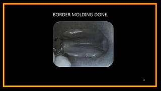 BORDER MOLDING DONE.
49
 