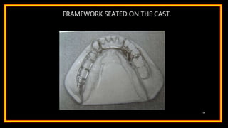 FRAMEWORK SEATED ON THE CAST.
58
 